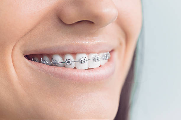 Why Choose Us for Your Dental Needs in Lake Barrington, IL